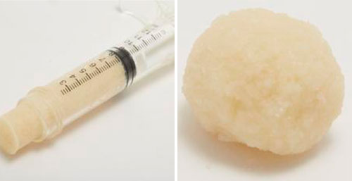 Infinity DBM Putty is formable and injectable. The graft resists irrigation and can be used to augment autologous cancellous or cortico-cancellous grafts. Infinity DBM Putty is entirely derived from human allograft bone tissue. [themify_button color="#dc1b1c" size="small" link="/allogenics/#bonechips"  text="#ffffff" ]LEARN MORE[/themify_button]