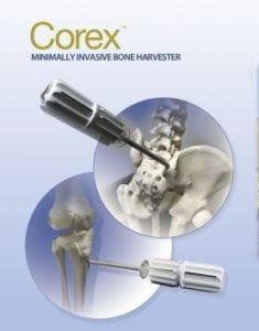 The next revolution in Iliac crest harvesting, capturing gold standard autograft for fusion procedures. Available in 7 mm or 9 mm. Invented by a innovative and forward thinking spine surgeon, who observed the need and created this niche bone recovery device for Gold Standard graft harvesting.